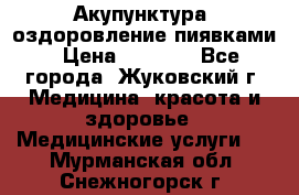 Акупунктура, оздоровление пиявками › Цена ­ 3 000 - Все города, Жуковский г. Медицина, красота и здоровье » Медицинские услуги   . Мурманская обл.,Снежногорск г.